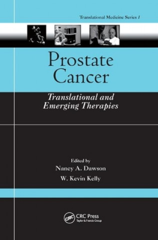 Kniha Prostate Cancer 