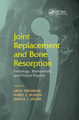 Książka Joint Replacement and Bone Resorption 