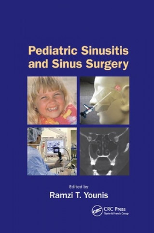 Buch Pediatric Sinusitis and Sinus Surgery 