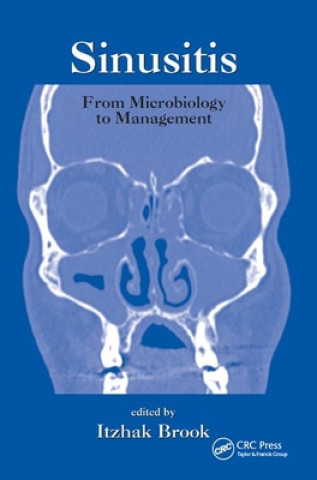 Buch Sinusitis 