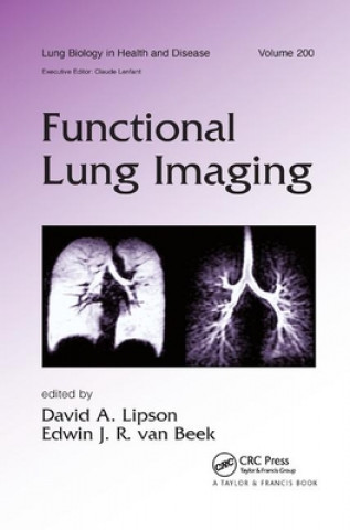 Kniha Functional Lung Imaging 