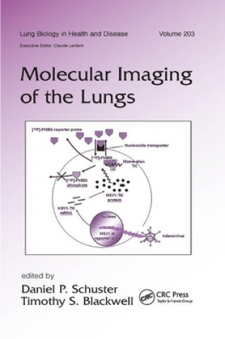 Książka Molecular Imaging of the Lungs 