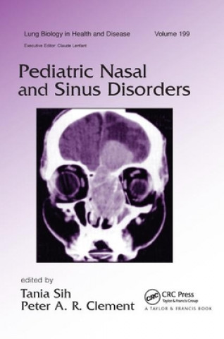 Книга Pediatric Nasal and Sinus Disorders 