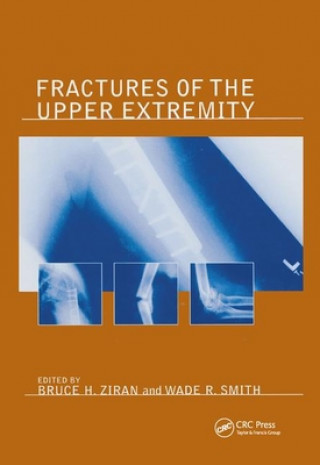 Knjiga Fractures of the Upper Extremity Bruce H. Ziran