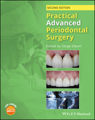 Книга Practical Advanced Periodontal Surgery, 2nd 2nd Edition Serge Dibart