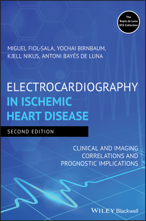 Kniha Electrocardiography in Ischemic Heart Disease - Clinical and Imaging Correlations and Prognostic Implications 2e MIGUEL FIOL SALA