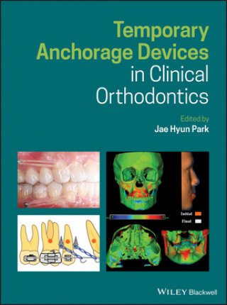 Książka Temporary Anchorage Devices in Clinical Orthodontics Jae Hyun Park