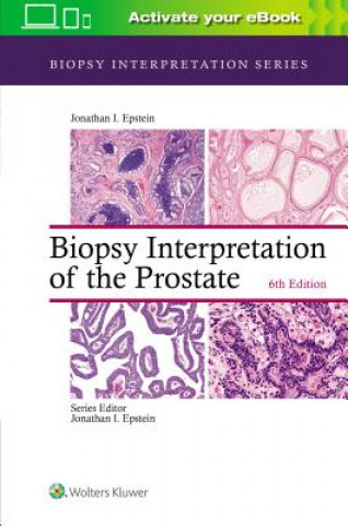 Könyv Biopsy Interpretation of the Prostate Jonathan I. Epstein