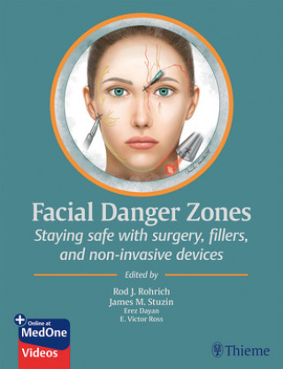 Knjiga Facial Danger Zones James Stuzin
