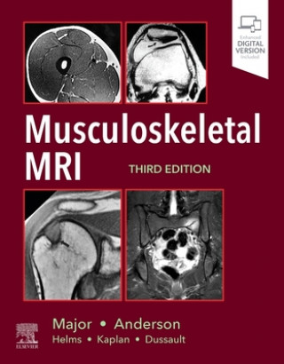 Kniha Musculoskeletal MRI NANCY M. MAJOR