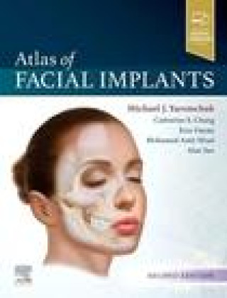 Carte Atlas of Facial Implants MICHAEL J YAREMCHUK