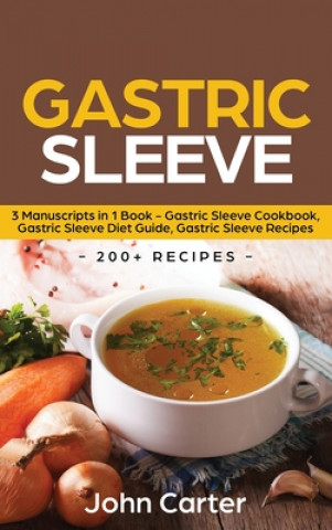 Könyv Gastric Sleeve 