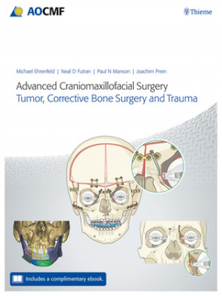 Книга Advanced Craniomaxillofacial Surgery Paul Manson