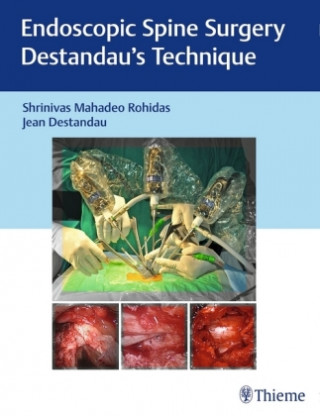 Knjiga Endoscopic Spine Surgery Shrinivas Mahadeo Rohidas