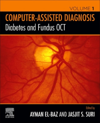 Knjiga Diabetes and Fundus OCT Jasjit S. Suri