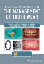 Kniha Practical Procedures in the Management of Tooth Wear Subir Banerji