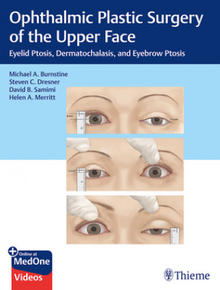 Könyv Ophthalmic Plastic Surgery of the Upper Face Michael Burnstine