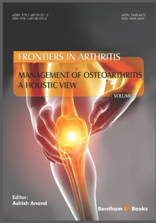 Kniha Management of Osteoarthritis - a Holistic View, (Frontiers in Arthritis, Volume 1) 