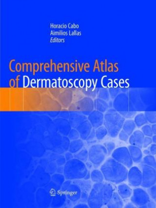 Könyv Comprehensive Atlas of Dermatoscopy Cases Horacio Cabo