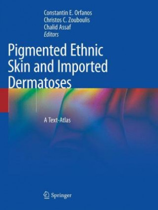 Knjiga Pigmented Ethnic Skin and Imported Dermatoses Constantin E. Orfanos
