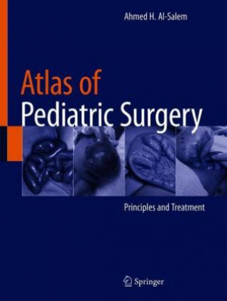 Carte Atlas of Pediatric Surgery Ahmed H. Al-Salem