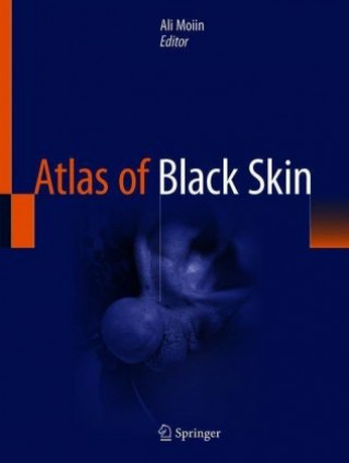 Kniha Atlas of Black Skin Ali Moiin