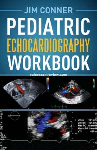 Carte Pediatric Echocardiography Workbook 
