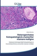 Heterogenitatea histopatologic? a tumorilor mamare maligne