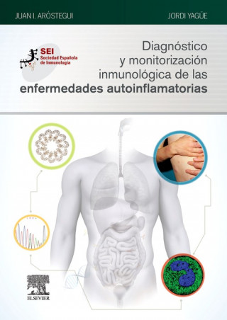 Kniha DIAGNÓSTICO Y MONITORIZACIÓN INMUNOLÓGICA DE LAS ENFERMEDADES AUTOINFLAMATORIAS JUAN I. AROSTEGUI