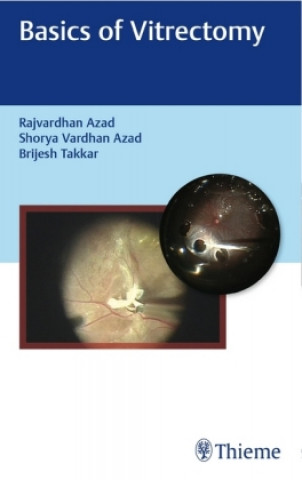 Kniha Basics of Vitrectomy 