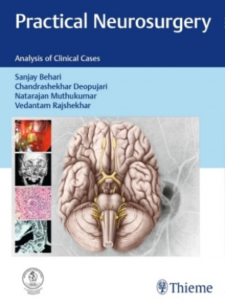 Kniha Practical Neurosurgery 