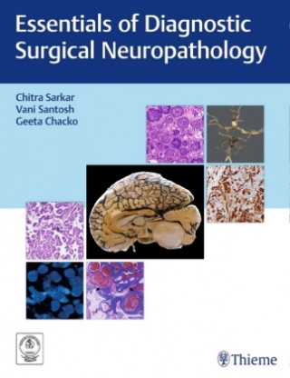 Könyv Essentials of Diagnostic Surgical Neuropathology Chitra Sarkar