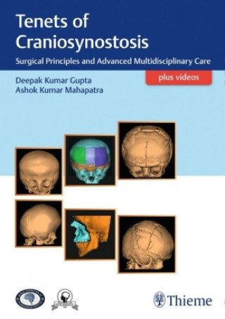 Kniha Tenets of Craniosynostosis Deepak Gupta