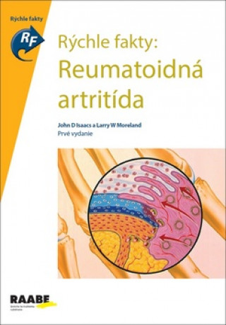 Knjiga Rýchle fakty: Reumatoidná artritída autorov Kolektív