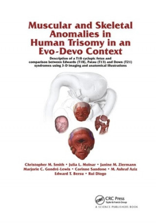 Kniha Muscular and Skeletal Anomalies in Human Trisomy in an Evo-Devo Context Rui Diogo