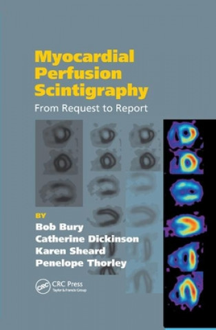 Könyv Myocardial Perfusion Scintigraphy Bob Bury