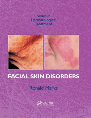 Kniha Facial Skin Disorders Ronald Marks