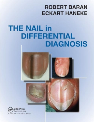 Knjiga Nail in Differential Diagnosis Robert Baran