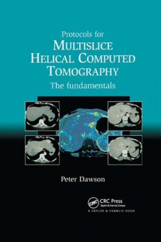 Book Protocols for Multislice Helical Computed Tomography Dawson Peter