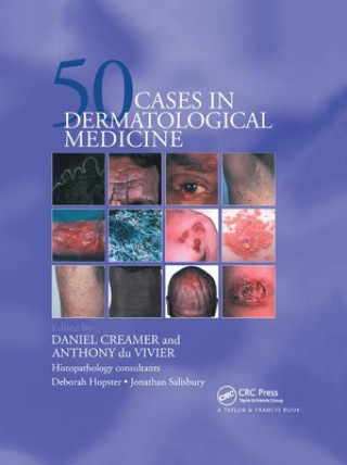 Kniha Fifty Dermatological Cases Daniel Creamer