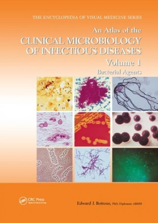 Carte Atlas of the Clinical Microbiology of Infectious Diseases, Volume 1 Edward J. Bottone