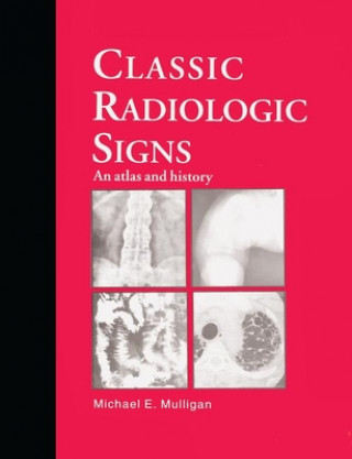 Carte Classic Radiologic Signs M. E. Mulligan