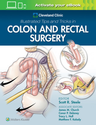 Könyv Cleveland Clinic Illustrated Tips and Tricks in Colon and Rectal Surgery Steele