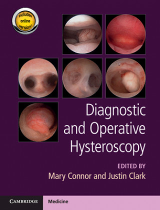 Carte Diagnostic and Operative Hysteroscopy Justin Clark