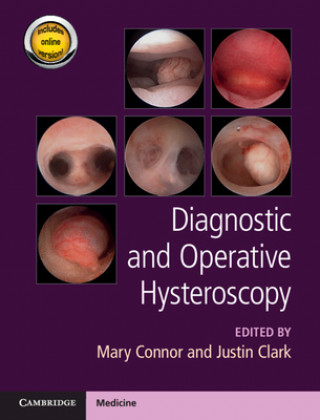 Libro Diagnostic and Operative Hysteroscopy Justin Clark