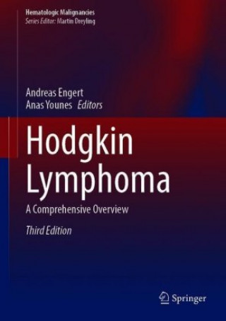 Kniha Hodgkin Lymphoma Andreas Engert