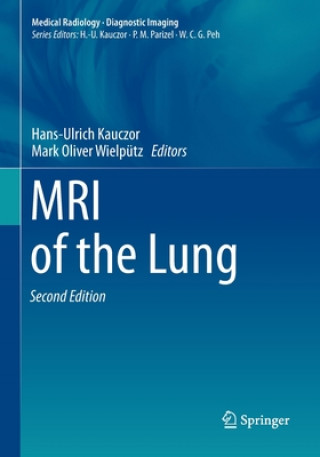 Книга MRI of the Lung Hans-Ulrich Kauczor