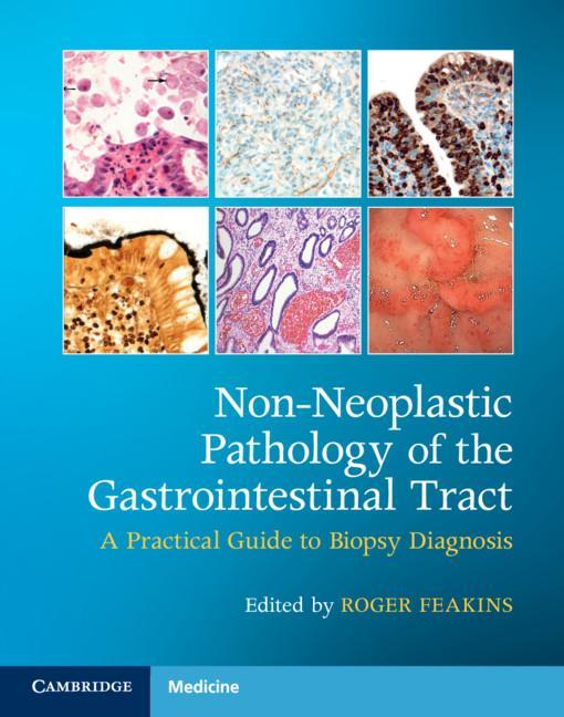 Könyv Non-Neoplastic Pathology of the Gastrointestinal Tract with Online Resource Roger Feakins