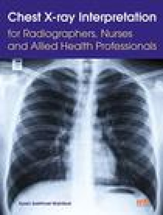 Kniha Chest X-ray Interpretation for Radiographers, Nurses and Allied Health Professionals 