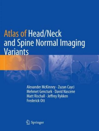 Könyv Atlas of Head/Neck and Spine Normal Imaging Variants Alexander McKinney